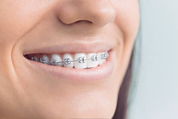 Best Dental Bonding  in Springfield, MA